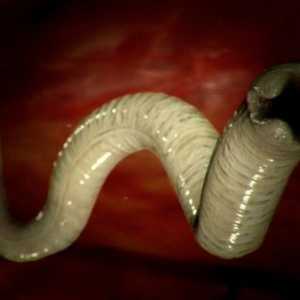 Kakšne so dimenzije črvi (paraziti) pri ljudeh?