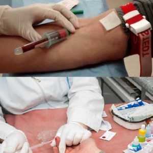 Kaj je krvni test ugotovi, črvi v otroka in odraslega, splošno, IFA, od veno?