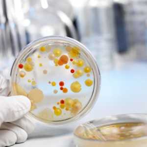 E. coli in bakterije zaraščanje