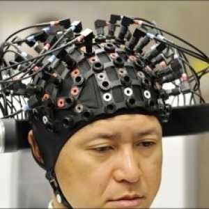 Klinična Elektroencefalografija (EEG)