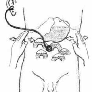 Klinično sliko spodnji ud kronične venske insuficience