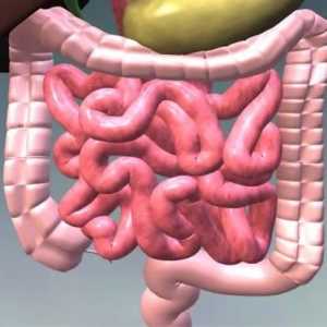 Kolonoptoz črevesa prolaps prečne debelega črevesa