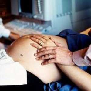 Listerioza v nosečnosti, simptomi, zdravljenje
