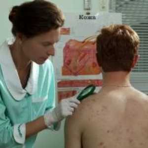 Metode za diagnozo bolezni kože