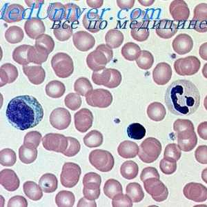 Uničenje hemoglobina. Različne anemias