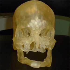Model za presaditev obraza se lahko natisne na 3D-tiskalnik