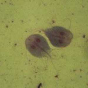 Lahko Giardia v urogenitalnega sistema povzročijo vnetje mehurja?