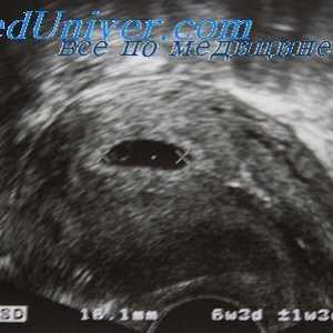 Ali je potrebno opraviti ultrazvok vsak noseča. Kolikor je potrebno ultrazvočni pregled nosečnic?