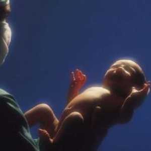 Non-nalezljive bolezni kože, podkožja, popkovna in popkovna rana ravnovesje pri novorojenčkih