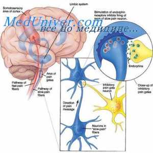 Nevroblastom otroci. Razvoj nevroblastoma pri otrocih