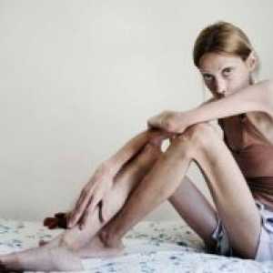 Anoreksija nervoza: zdravljenje, simptomi, znaki, vzroki