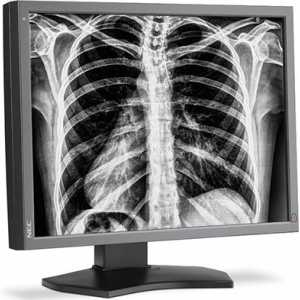 Nov monitor za radiologe