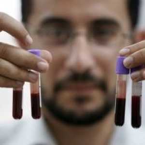 Preizkus pacientov z boleznimi sistema krvnega