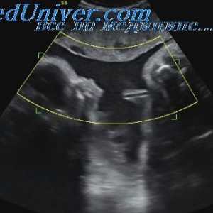 Pogovorite varnosti uporabe ultrazvoka. Vpliv ultrazvoka na tkivo