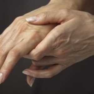 Zapora zgornjih okončin (roke, prsti): Zdravljenje, vzroki, simptomi