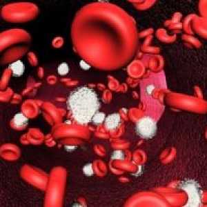Akutna anemija posledica izgube krvi