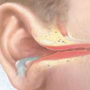 Akutni gnojno vnetje srednjega ušesa: zdravljenje, simptomi, znaki, vzroki