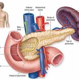 Akutni pankreatitis pri sladkorni bolezni