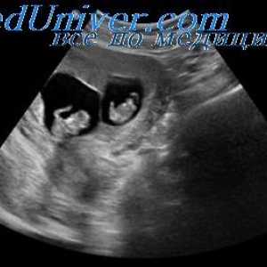 Odbiti ultrazvočni valovi. Proizvodnja in odkrivanje ultrazvoka