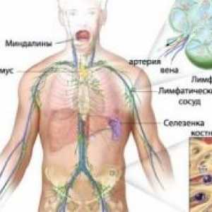 Primarni centralni živčni sistem limfom