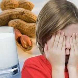 Alergije na hrano pri otrocih, starejših od 7 let
