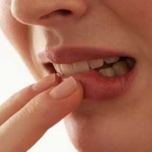 Ploščatoceličnega karcinoma ustne votline: zdravljenje, simptomi, prognoza
