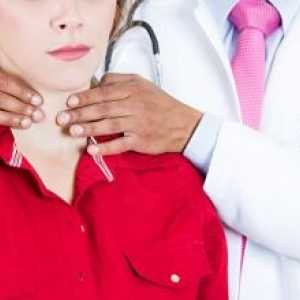 Subakutni tiroiditis ščitnice: Zdravljenje, simptomi, učinki, diagnoze