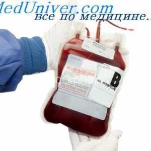 Indikacije in kontraindikacije za transfuzije rdečih krvnih celic pri novorojenčkih
