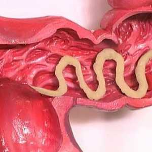 Povečan apetit s črvi (helminti)