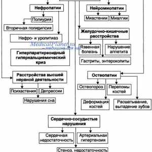 Hiperparatiroidizem in osteodistrofije paratirioidnaya. Fibrocistične osteitis in von…