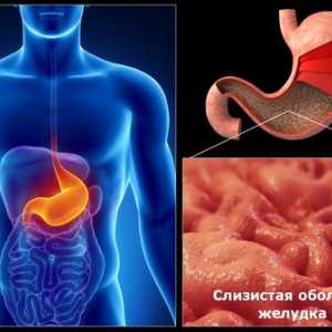 Vzroki kroničnega gastritisa