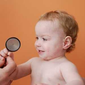 Okužbe prehladov zgornjih dihalnih poti pri otrocih