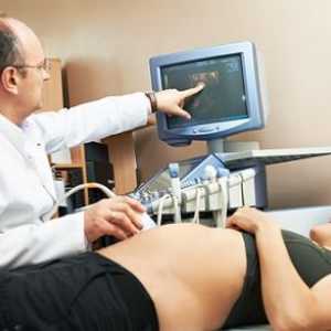 Molarna nosečnost v času nosečnosti, znaki, simptomi, vzroki, zdravljenje
