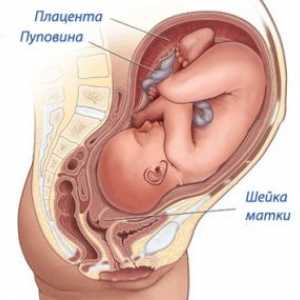 Maternični vrat pred rojstvom, simptomi, znaki