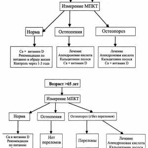 Različne glukokortikoidi zdravljenje osteoporoze