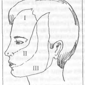 Vloga trigeminalnega živca v bolečinah obraza