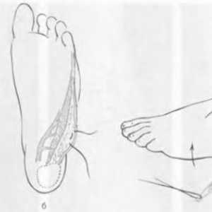 Brazgotina deformacija stopala in gležnja. napake Zdravljenje plantarna površine stopala