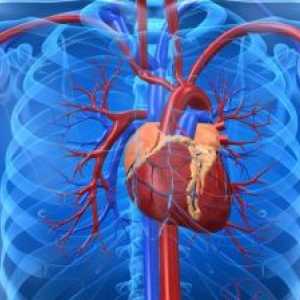 Srčno popuščanje v aterosklerotičnih cardiosclerosis, zdravljenje, vzroki