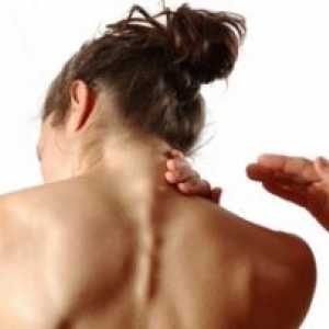 Materničnega vratu osteohondroza (osteohondroza od vratne hrbtenice), zdravljenje, simptomi, znaki,…