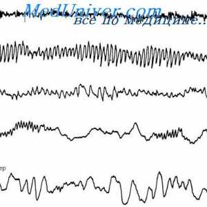 Možganski valovi in ​​ravni možganske aktivnosti. Elektroencefalogram (EEG) spanja
