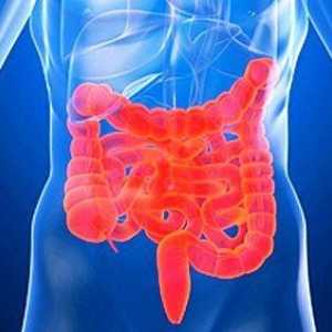 Simptomi sindroma razdražljivega črevesja (IBS)