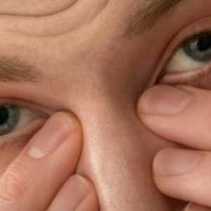 Sindrom suhega očesa, zdravljenje, simptomi, vzroki