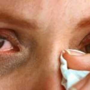Solzenje oči: zdravljenje, vzroki, simptomi, znaki