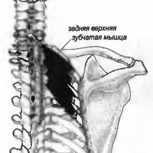 Bolečine v hrbtu, ki ga serratus povzroča