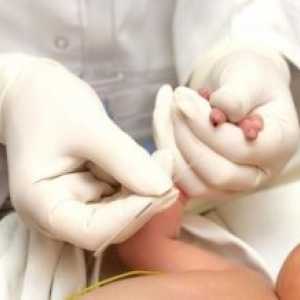 Novorojenčka testi