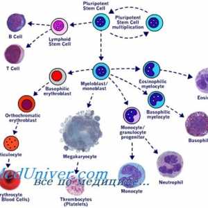 Presaditev matičnih celic v mieloproliferativne bolezni mieloleykoze