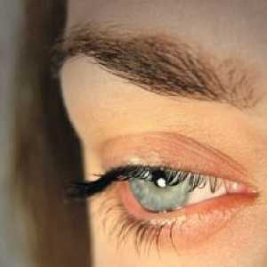 Poškodbe oči: zdravljenje, prva pomoč, vzroki, simptomi, znaki