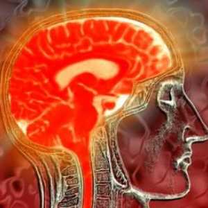 Tuberkuloznih vnetje možganskih ovojnic, centralni živčni škoda sistem