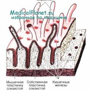 Prirojena imunost črevesja: del epitela
