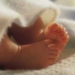 Bolezni otrok takoj po rojstvu